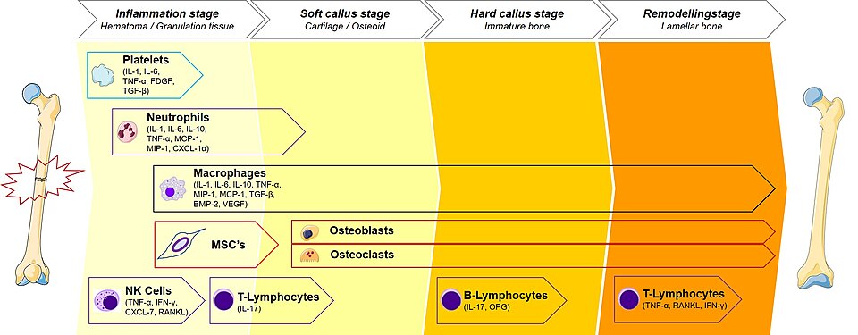 Células inmunes en las etapas de la consolidación