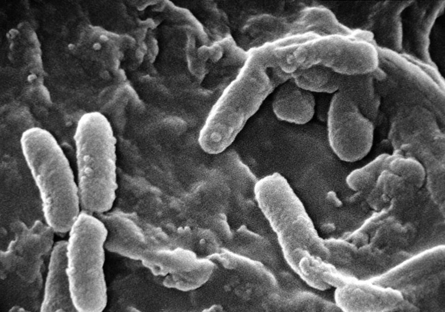 Pseudomonas aeruginosa vista con microscopio electrónico de barrido