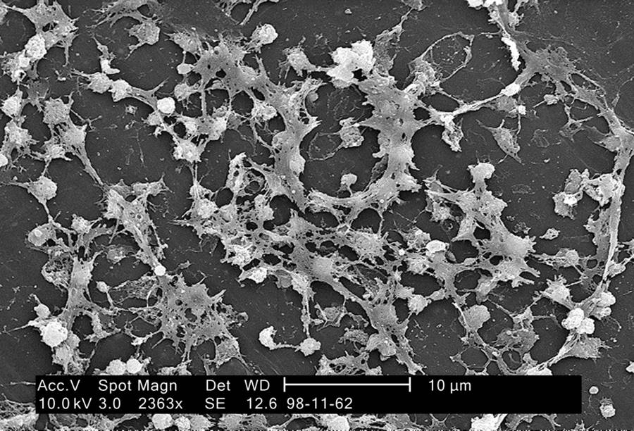S. aureus sobre la luz de un catéter, unido por una sustancia pegajosa (biofilm)
