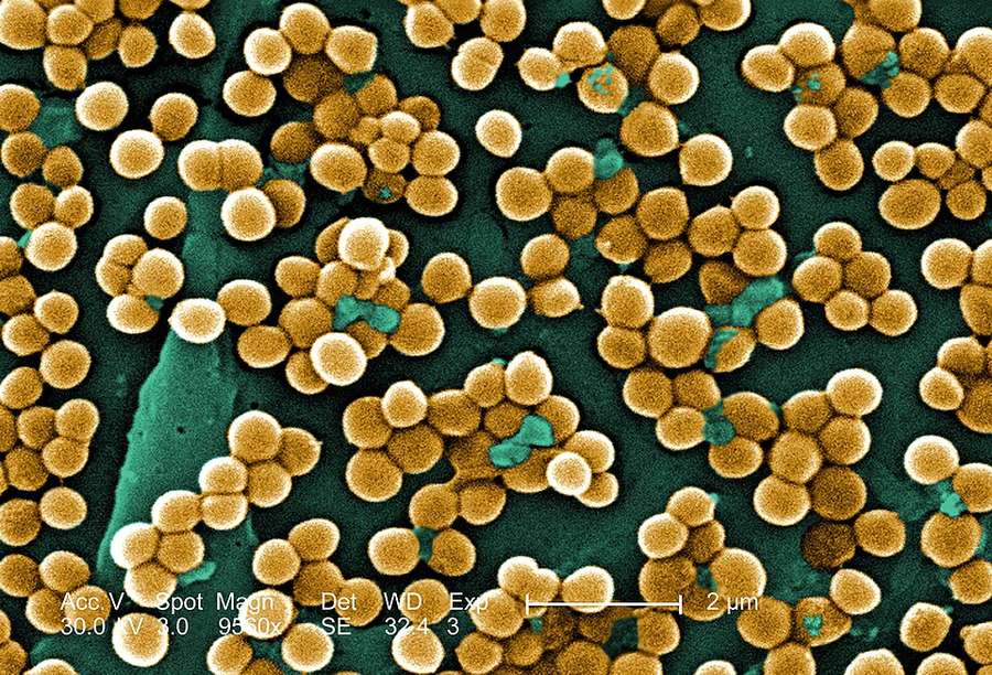 Staphylococcus aureus resistente a meticilina (MRSA) en microscopía electrónica de barrido coloreada
