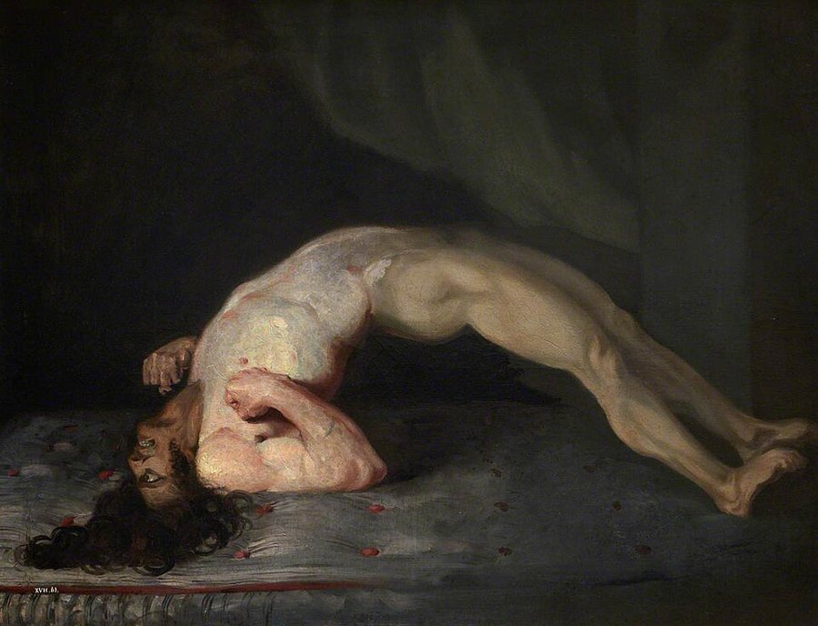 Opistótono en un paciente con tétanos (pintura de Charles Bell, 1809)