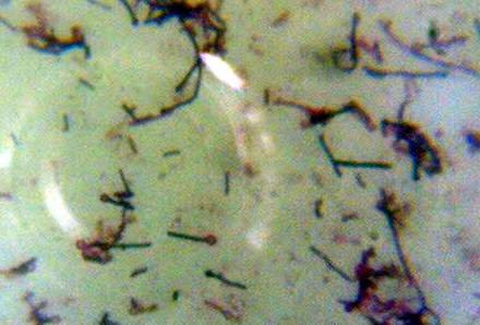 Clostridium tetani en tinción de Gram